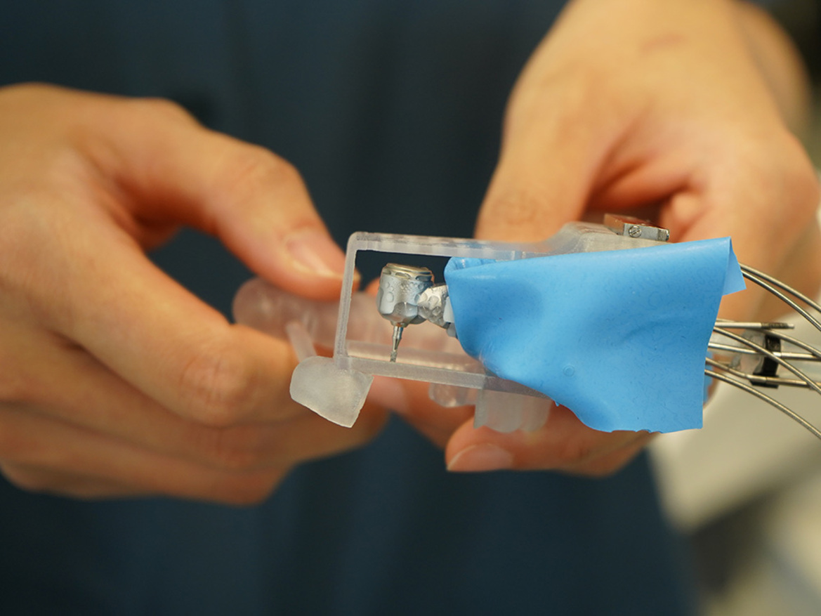 Mini Robot Dentist Fits Inside Your Mouth To Precision Drill For Crowns